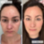 Thumbnail: Omnilux Contour Face