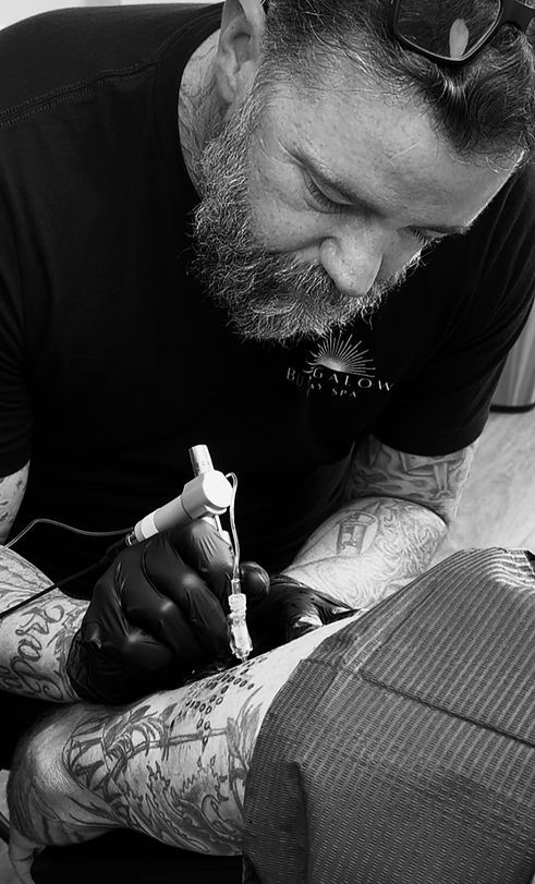 Central Coast Non-Laser Tattoo Removal in Pismo Beach by Darrel Ashmore