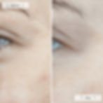 Thumbnail: Omnilux Contour Face