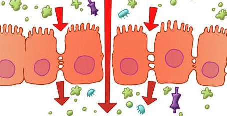 La porosité intestinale