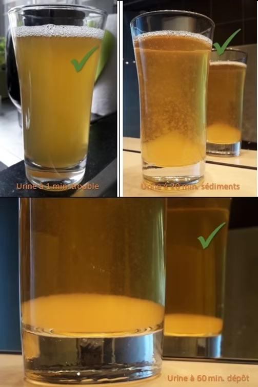 Urine normale, les reins filtrent les déchets
