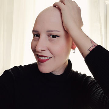 Mujeres Calvas: quebrar o tabu da alopecia feminina