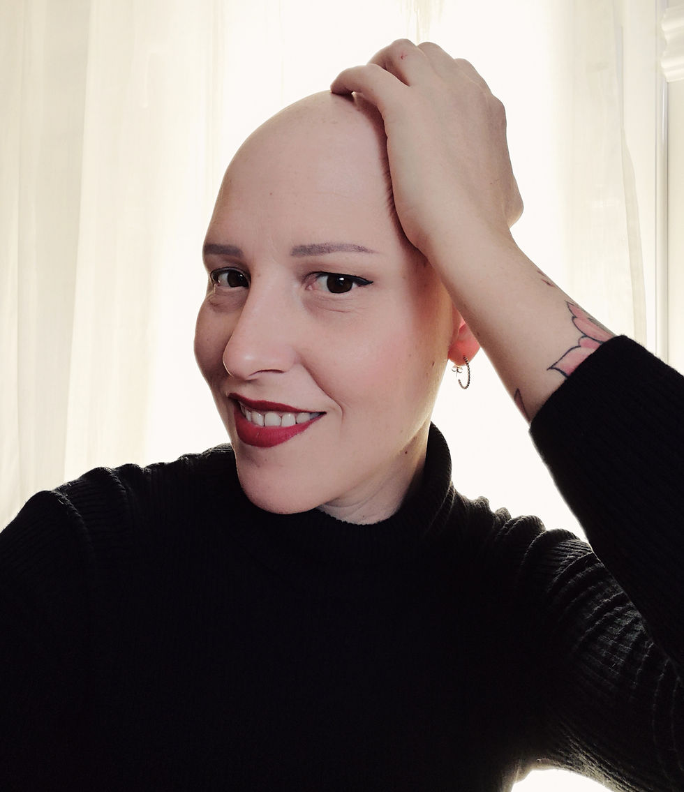 Mujer con alopecia. Chiara Cabello especialistas en perdida de cabello en mujer, pelucas naturales oncológicas y turbantes juveniles alopecia. Tienda de pelucas en España con envío gratis