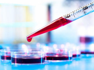 नये शोध में हुआ खुलासा, रक्त पहले से बताता है कौन सी बीमारियों का है खतरा