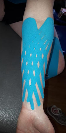 kinesiology taping for muscle pump