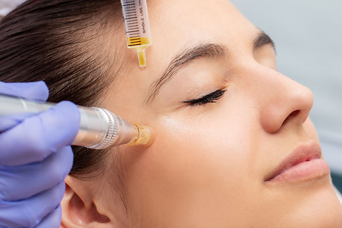 Microneedling Facial.jpeg