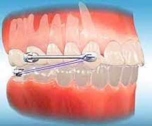 carriere 2_edited.jpg