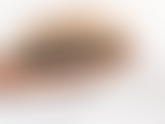 Checklist! for Early Symptoms of Hair Loss in Women