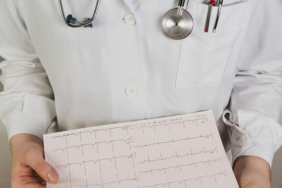 doctor with electrocardiogram results in his hands