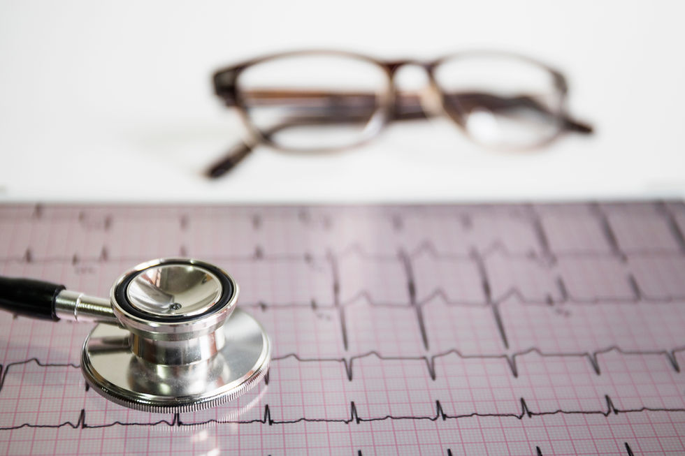 electrocardiogram results photo