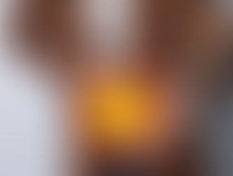 Síndrome do intestino irritável (SII): sintomas, causas e tratamentos para melhorar sua qualidade de vida