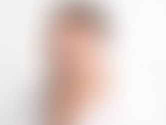 Pelos da barba encravados: por que acontecem e como evitar o problema