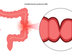 Transtornos funcionais do trato gastrointestinal