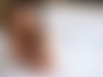 Dor pélvica crônica