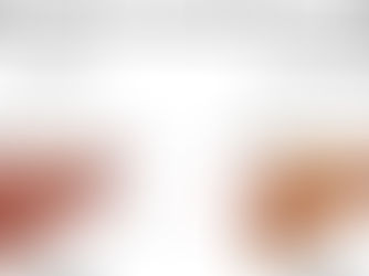 Hemocromatose, Doença de Wilson e Doenças Autoimunes