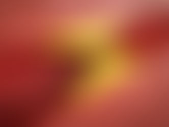 Aterosclerose: entenda a doença silenciosa que pode causar infarto e AVC