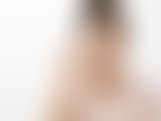 Queda de sobrancelha