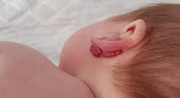 Principais Patologias Cirúrgicas do Recém-Nascido