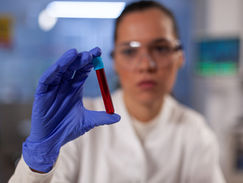 Biomarcadores sanguíneos