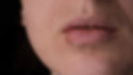 Herpes labial