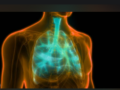 Pneumonite e pneumonia por aspiração