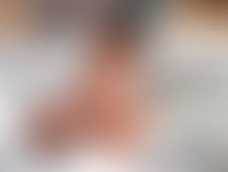 Pressão baixa: causas, sintomas e como tratá-la