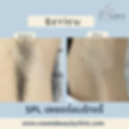 hair removal bangkok