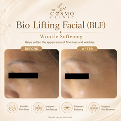 BLF Before After (1)