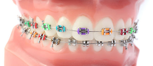 ortodonzia-800x350-1.x96980.jpg