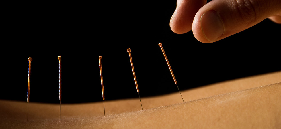 Escena de terapia de acupuntura
