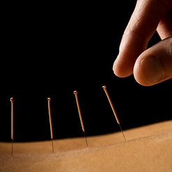 Acupuncture close up