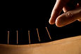 Acupuncture close up