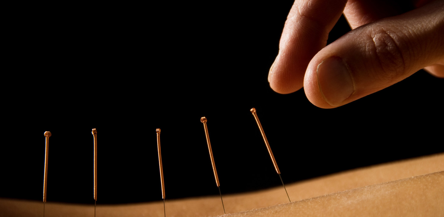 Acupuncture close up