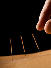Acupuncture close up
