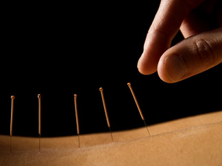 Acupuncture is worth a try for chronic pain
