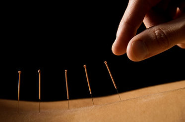 Acupuncture close up