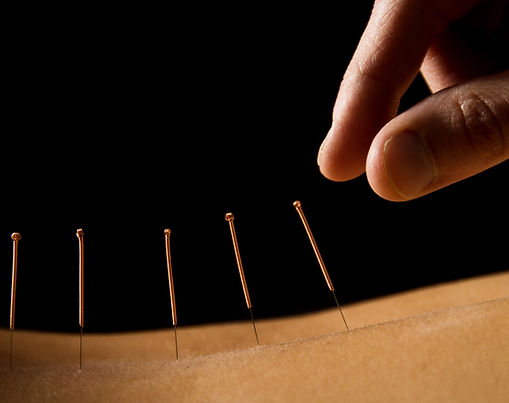 בכמה מחטים משתמשים בטיפול?