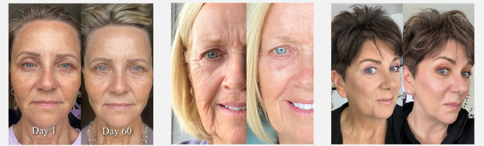 Skincare+Results+1.png