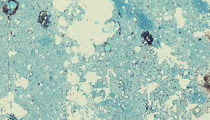 Closeup water droplets