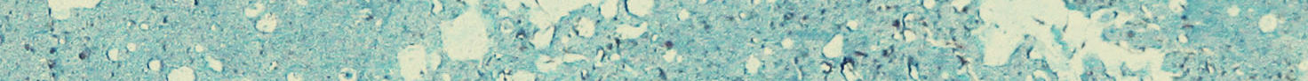 Closeup water droplets