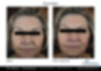 aggressive rapid medical weight loss