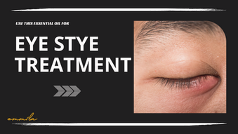 Use this Essential Oil for Eye Stye Treatment