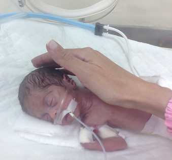 Mila inside the incubator with my hand inside touching her head