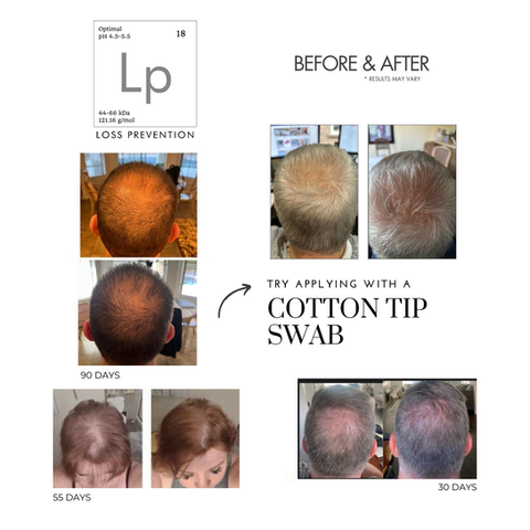 Before & After - using SCALP PHIX LOSS PREVENTION SERUM