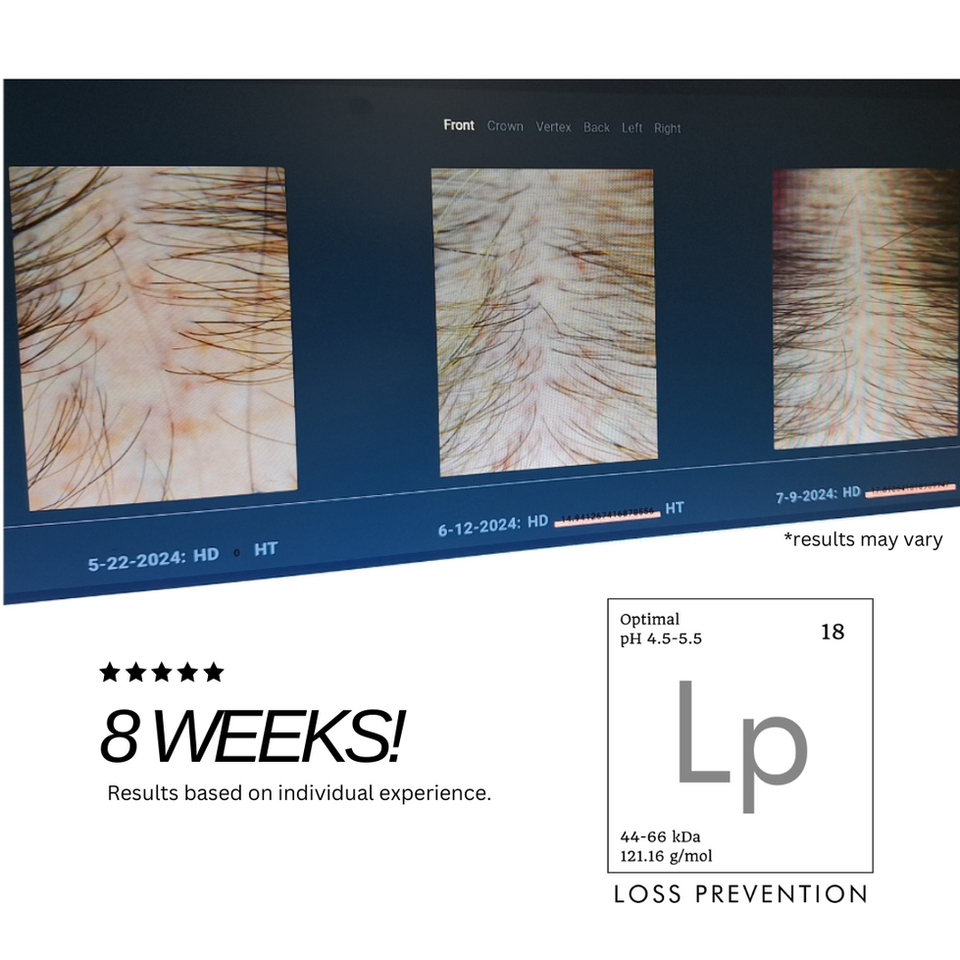 Before & After Results  
Only 8 weeks!  