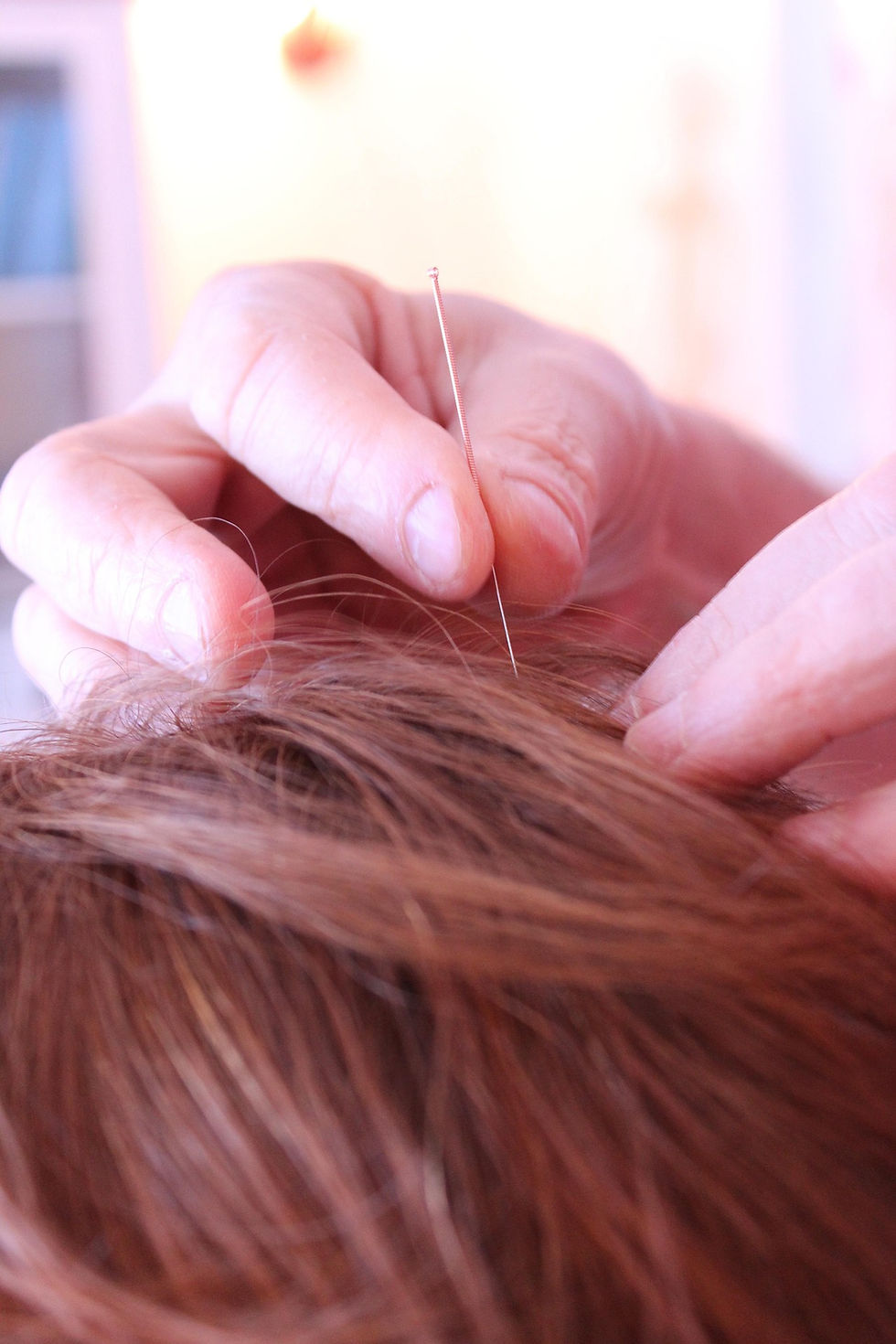 keskieve-acupuncture-656578_1920.jpg