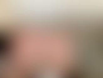 エアコンで冷えた体に。カッピングで巡りを整えませんか?