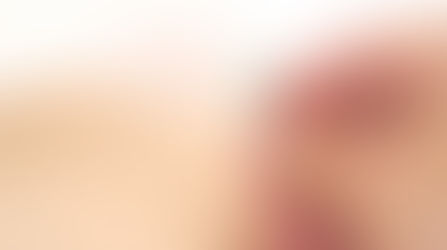 鍼での施術について