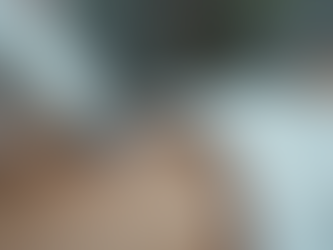 Laser Hair Removal Risks and Safety Tips