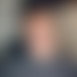 Episode 21 - A Freak Accident Broke Open My Soul